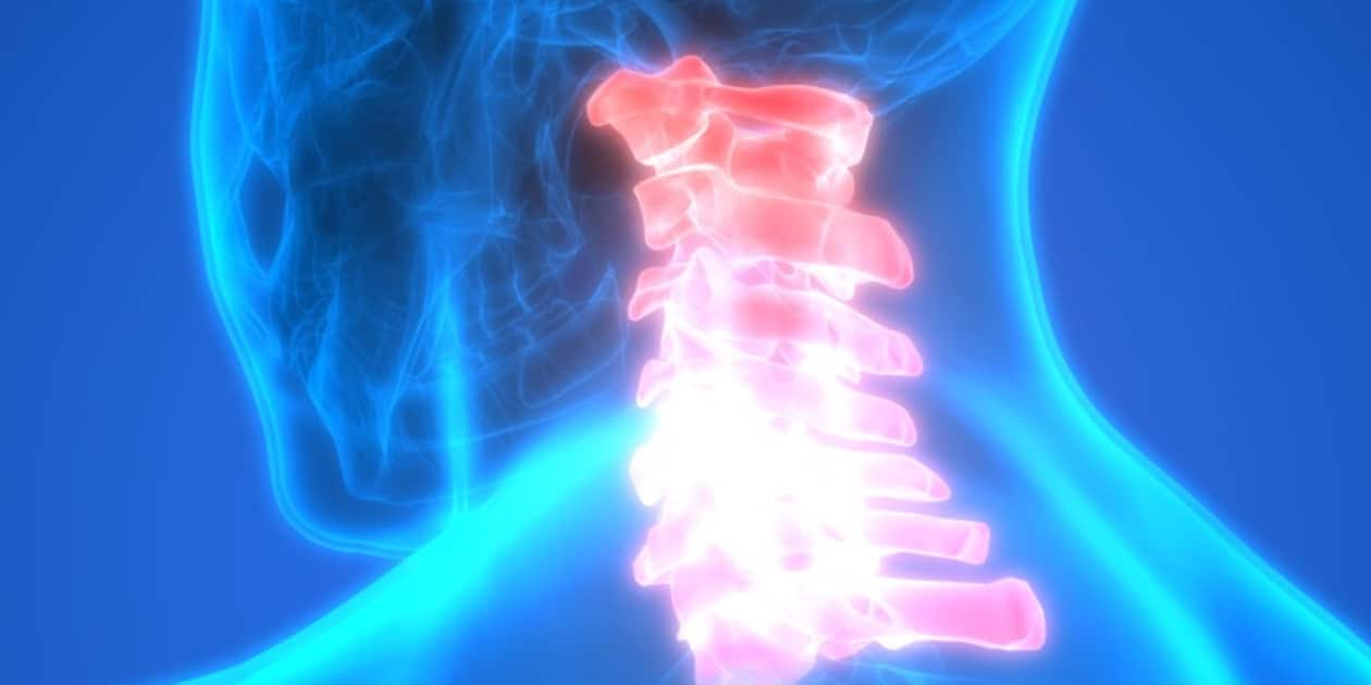 فرق دیسک گردن با آرتروز گردن چیست؟ 5 فرق دیسک گردن با آرتروز گردن